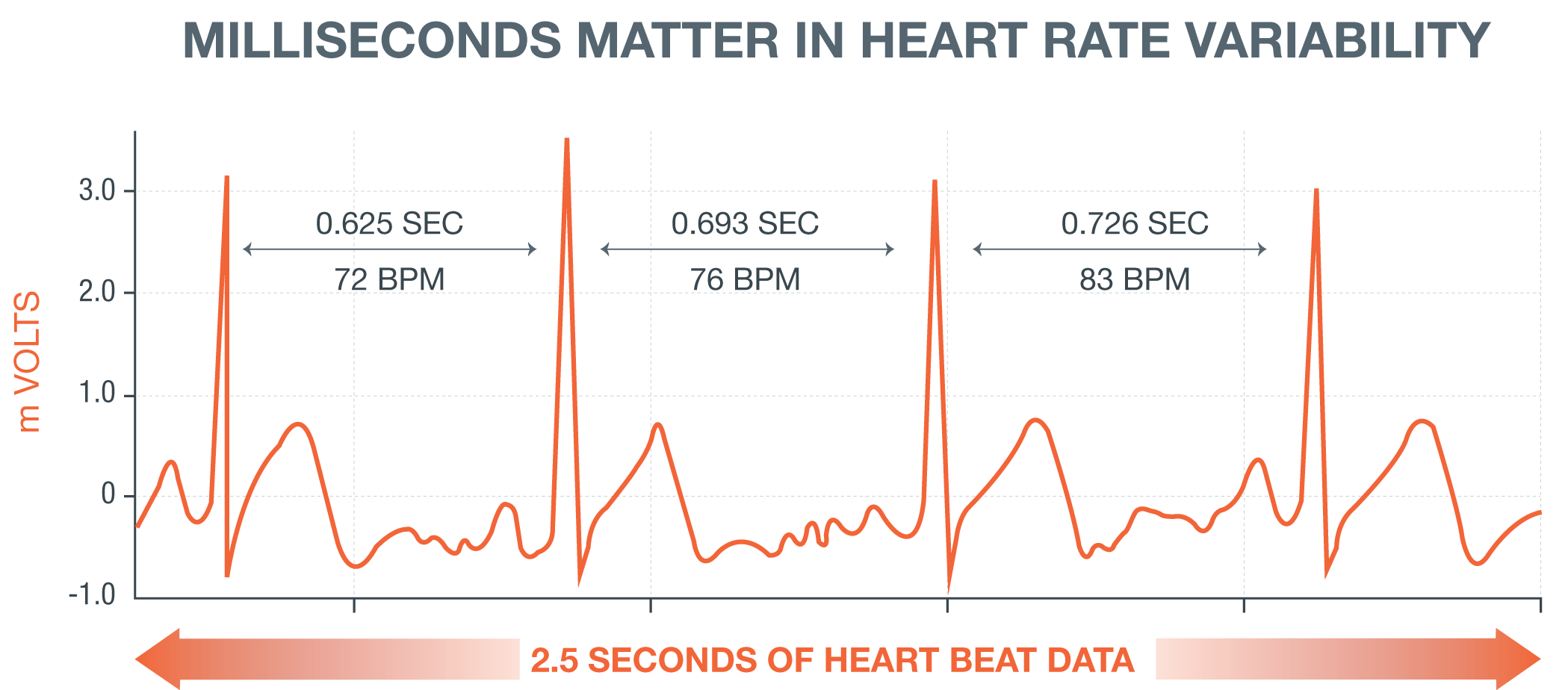 Image of a cardiogram with heading: Milliseconds matter in heart rate variability