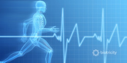 ECG with a man running, to indicate risks of sudden cardiac arrest during activity.